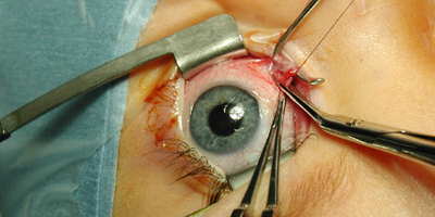 Eye Instruments